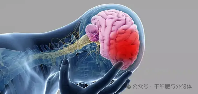 全球14项临床证明,间充质干细胞可有效减少中风后的致残率 全球14项临床证明,间充质干细胞可有效减少中风后的致残率